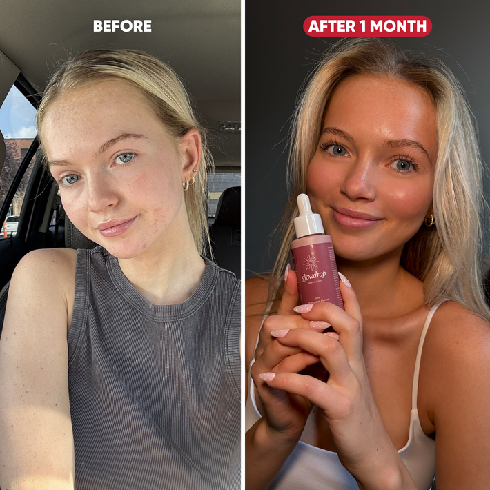 Antes y después Madeline