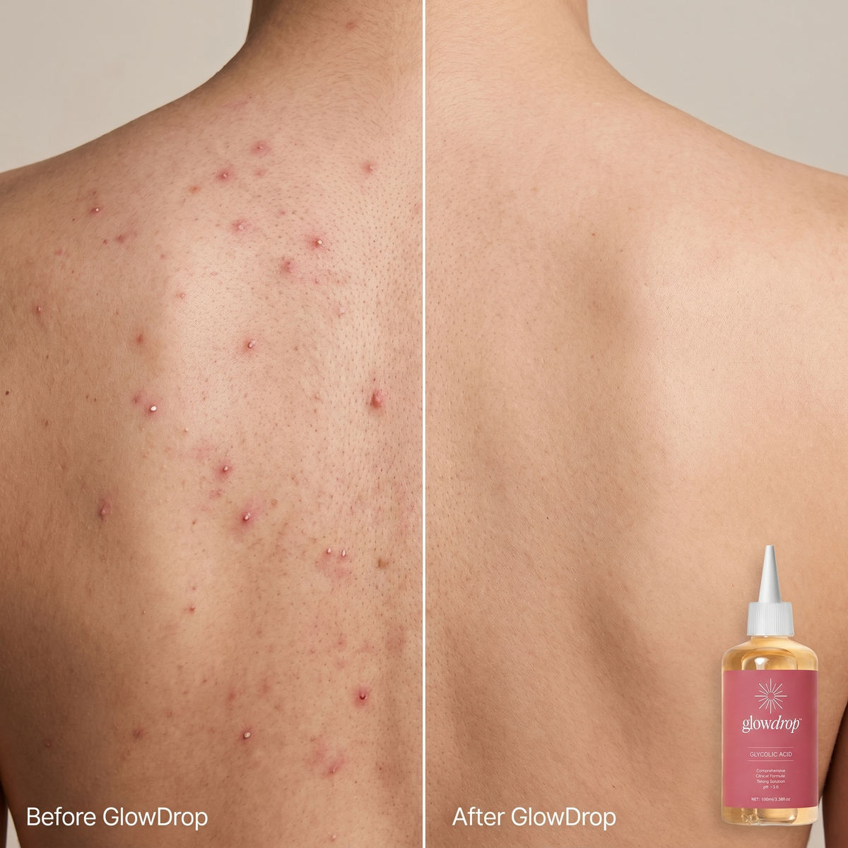GlowDrop Glycolic Acid
