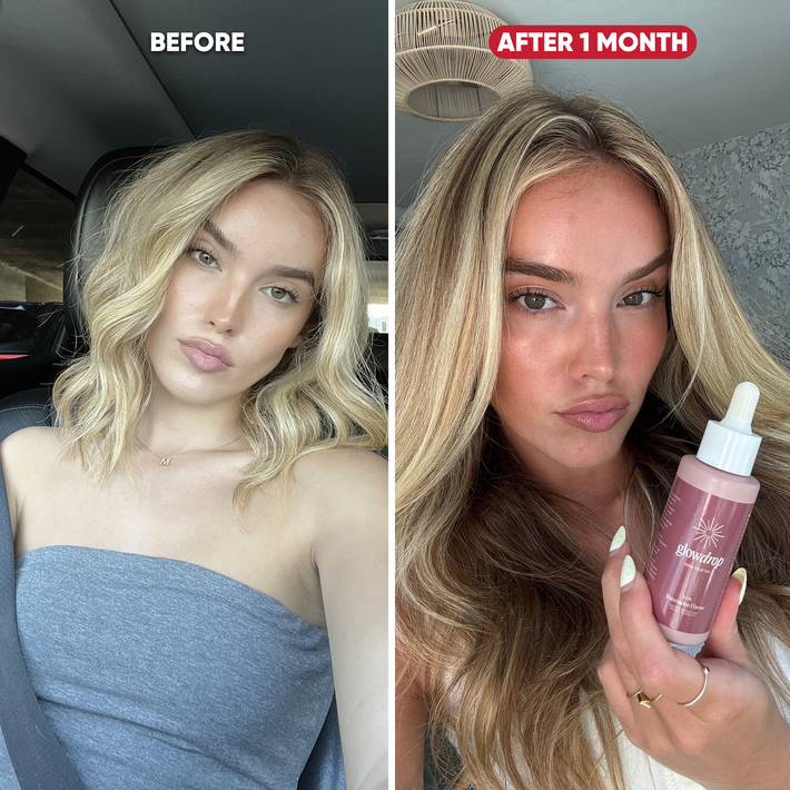 Antes y después Madi