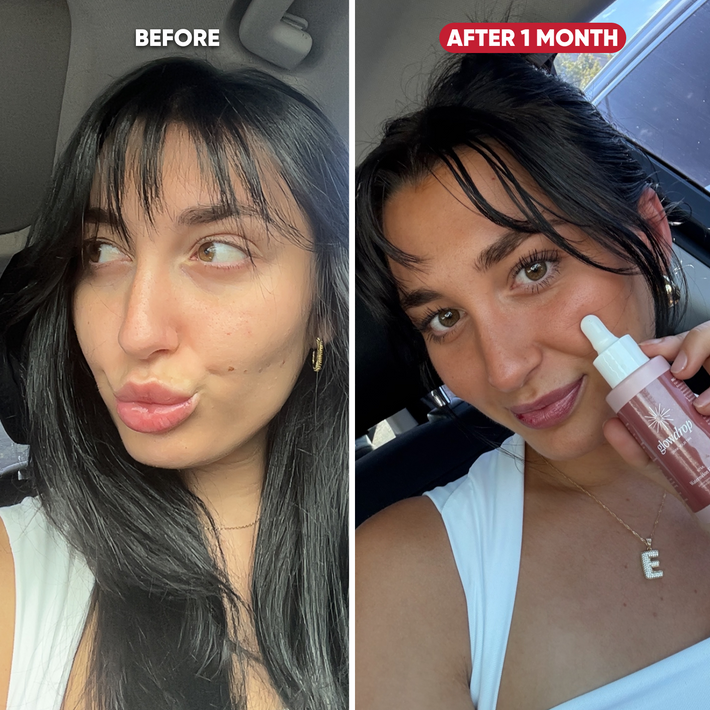 Antes y después Emmy
