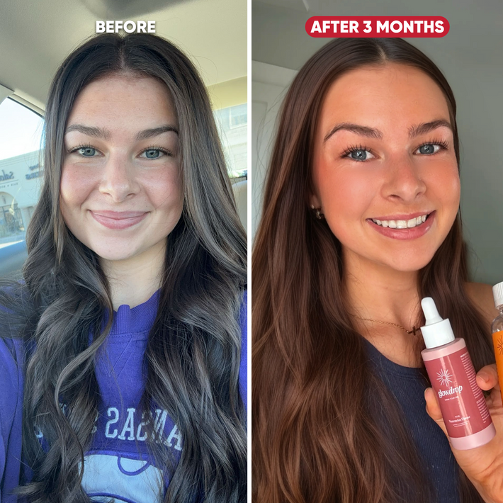Antes y después Melissa